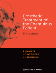 Prosthetic Treatment of the Edentulous Patient