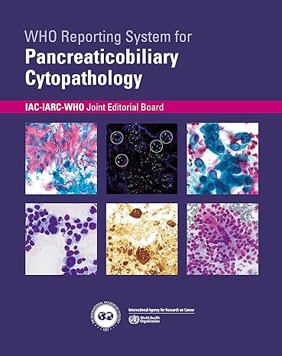 WHO Reporting System for Pancreaticobiliary Cytopathology